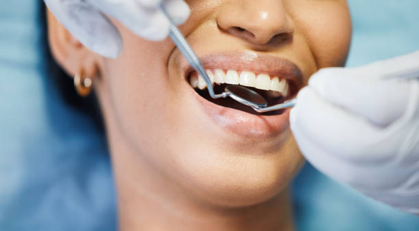 Best Emergency Dental Care for Sports Injuries in Heritage Pines, FL
