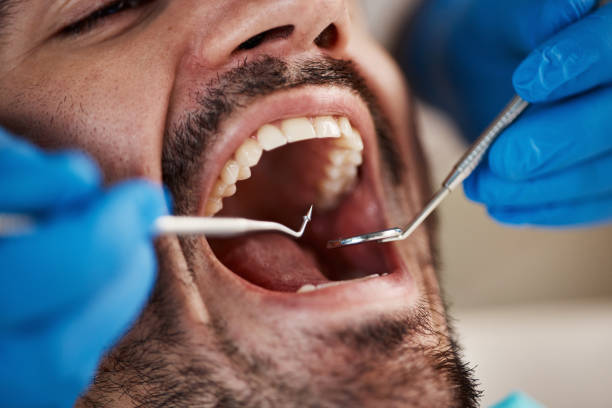 Best Emergency Denture Repair in Heritage Pines, FL